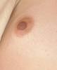 Left_nipple_close-up.jpg